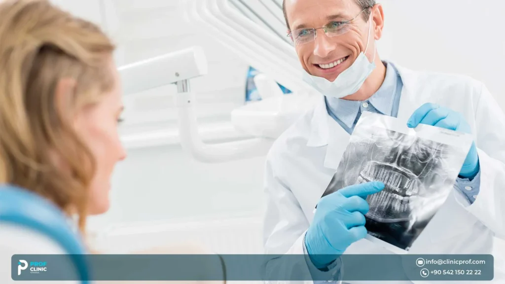 How do I clean my mouth during All-on-4 recovery?