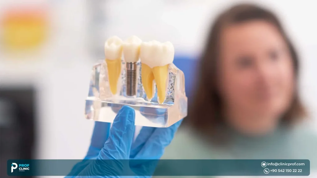 Implants for teenagers: when “not yet” is the right answer