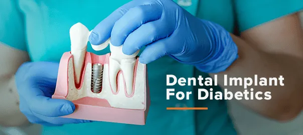 Dental Implants for Diabetics in Turkey: What You Need to Know