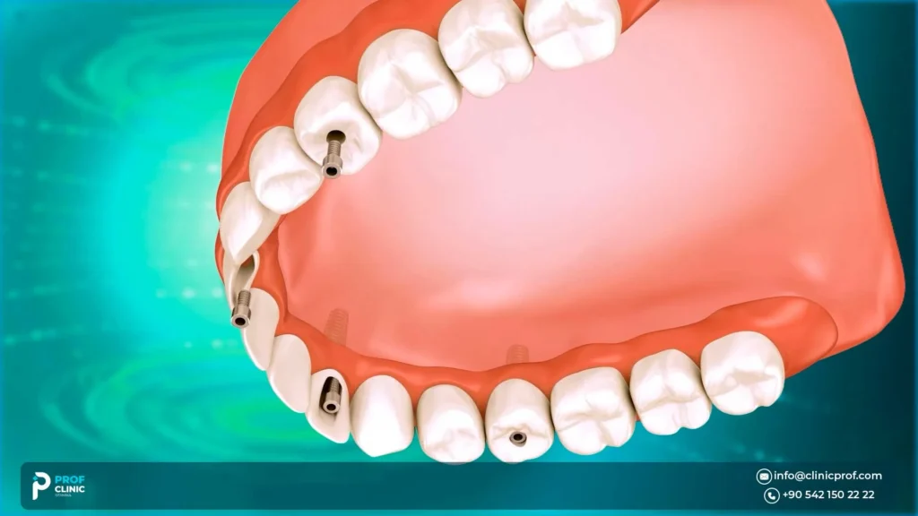 المسار الطبي الأمثل: هل تناسبك هذه التقنية وما هي البدائل المتاحة؟