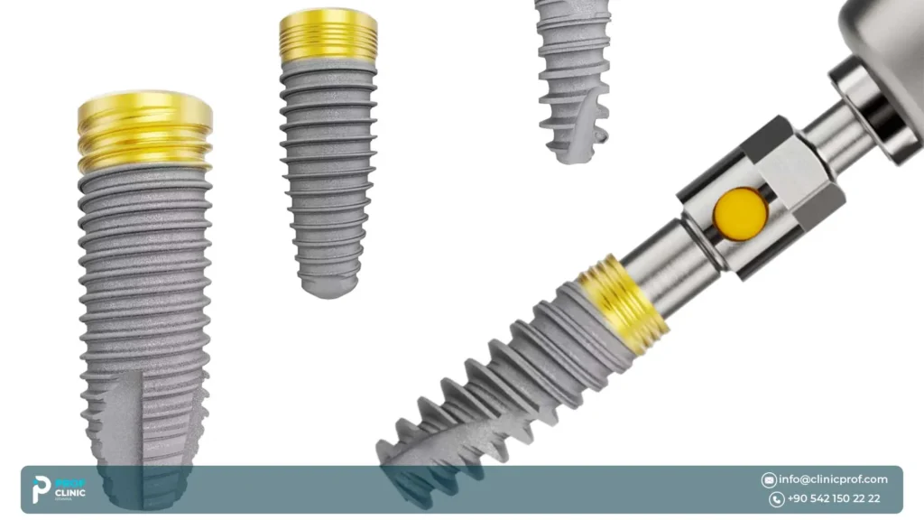  زرعات نوبل بيوكير: الرائد الأول في علم زراعة الأسنان