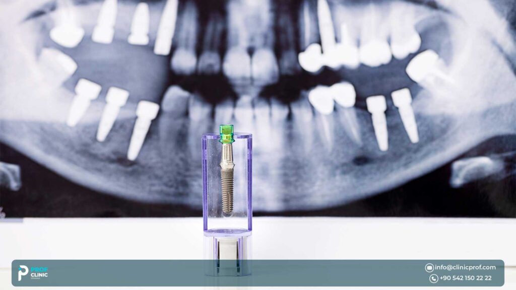 dental tourism and implants abroa