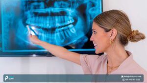 Sinus Lift Dental Implants: Surgery, Recovery, Risks & Alternatives