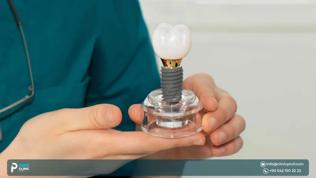 Care, maintenance, and replacement of implant crowns