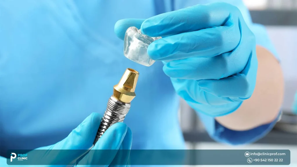 Implant consultation questions you should ask