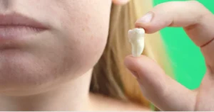 Swelling After Dental Implants in Turkey: What Is Normal and When to Call
