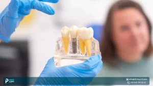 Types of Dental Implant Crown in Turkey: How to Choose the Right Material