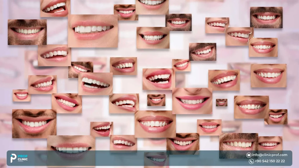Going abroad for dental implants