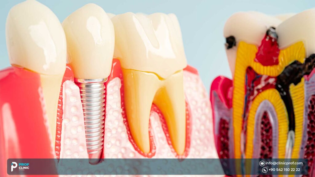 cheap dental travel turkey