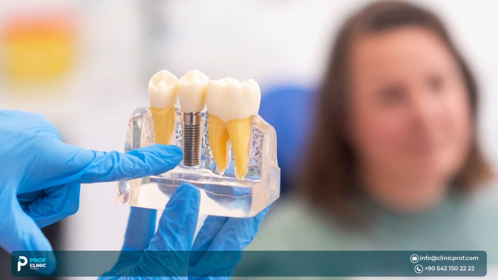 Cheapest Dental Implants Abroad: Best Value Without Compromise 2026