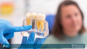 Cheapest Dental Implants Abroad: Best Value Without Compromise 2026