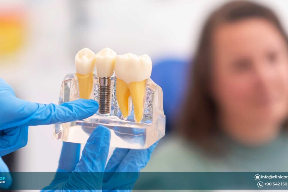 Cheapest Dental Implants Abroad: Best Value Without Compromise 2026
