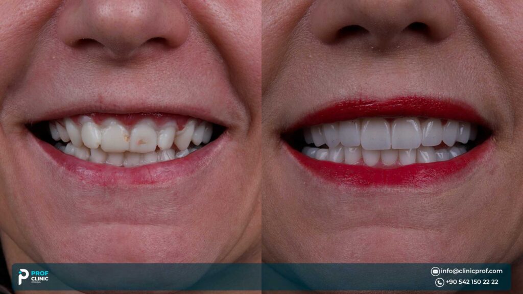 best dental clinics turkey dental tourism reviews
