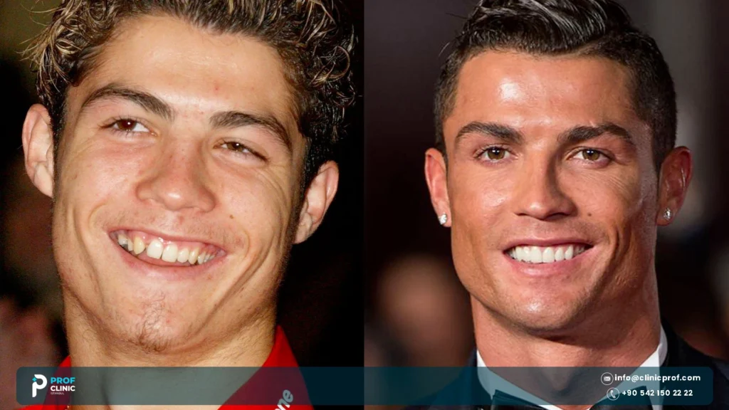 Cristiano Ronaldo Teeth Before and After: Braces to Smile Today 1 Cristiano Ronaldo teeth before and after
