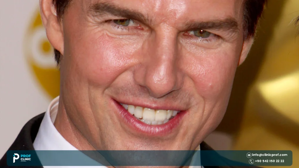 Tom Cruise Teeth: The Middle Tooth Story, Before and After 4 Tom Cruise Teeth: The Middle Tooth Story, Before and After 1000020692