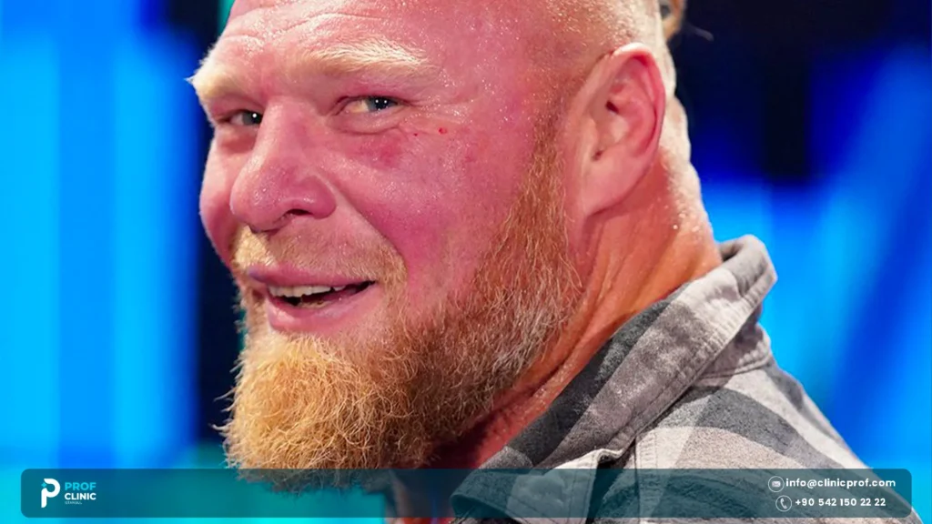 Brock Lesnar's Teeth Condition Over the Years