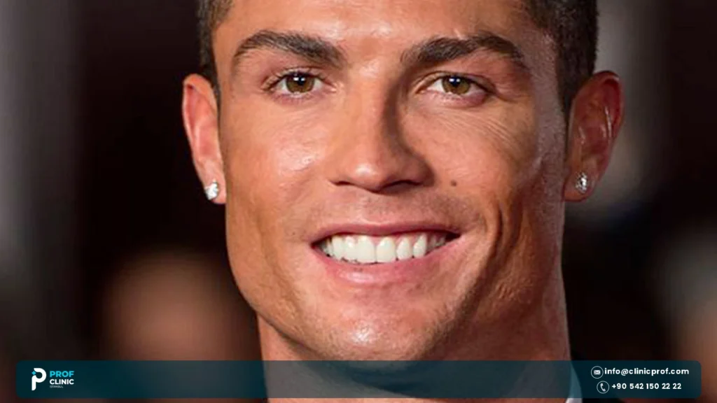 Cristiano Ronaldo Teeth Before and After: Braces to Smile Today