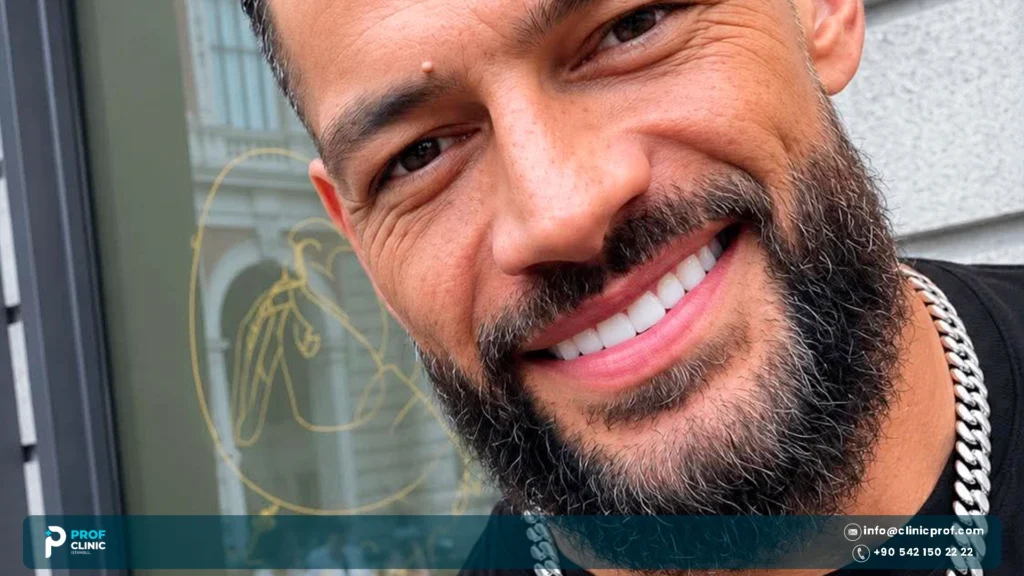 Roman Reigns Teeth: Ring Damage, Repairs and Smile Today 3 Roman Reigns veneers: Ring Damage & Repairs