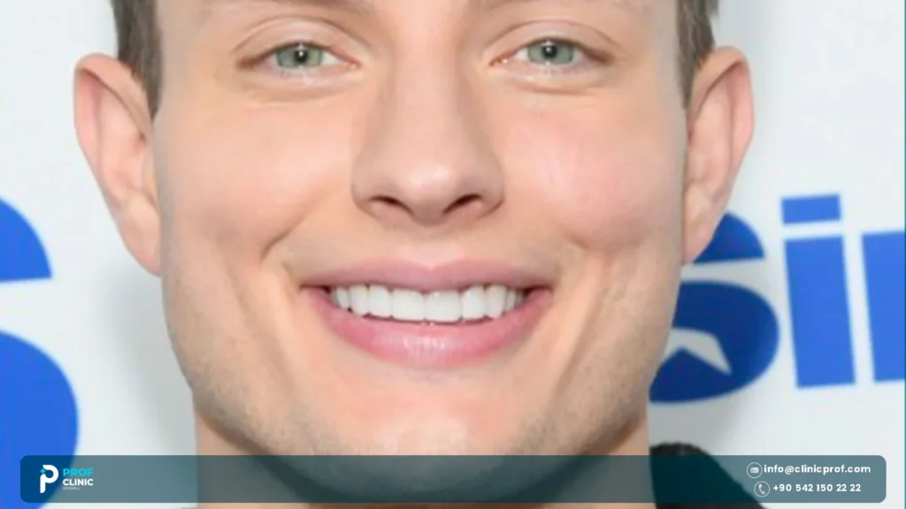 Before surgery glow up Matt Rife teeth