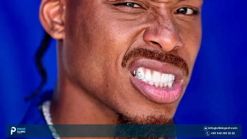 Justin Jefferson Teeth: Smile Changes Cost & Athlete Care