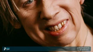shane macgowan new teeth pic