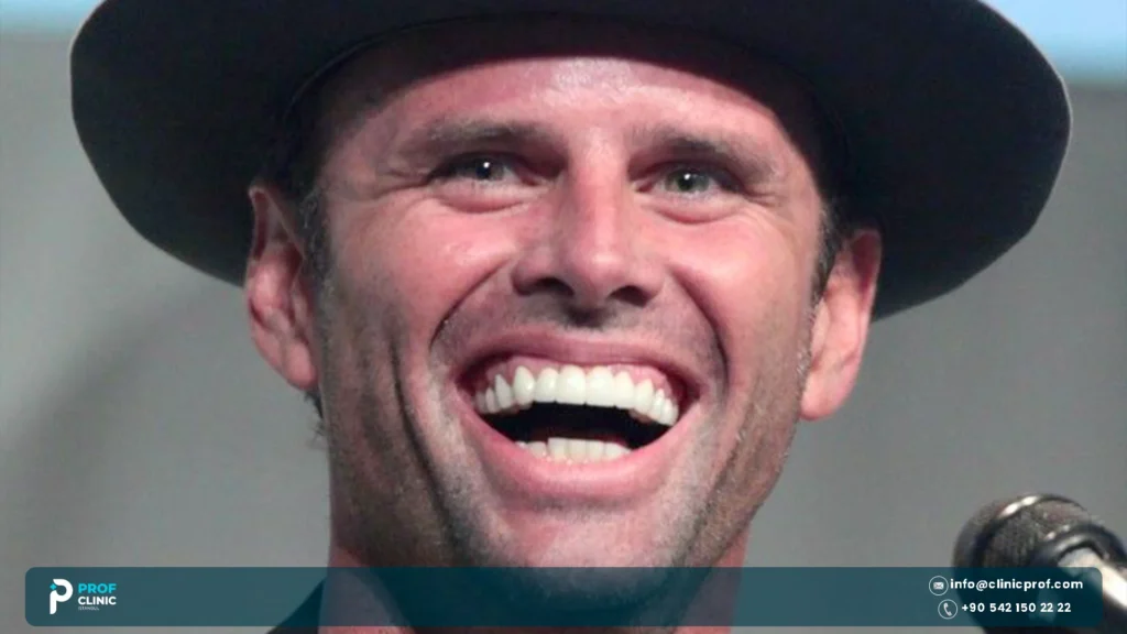 are walton goggins teeth real