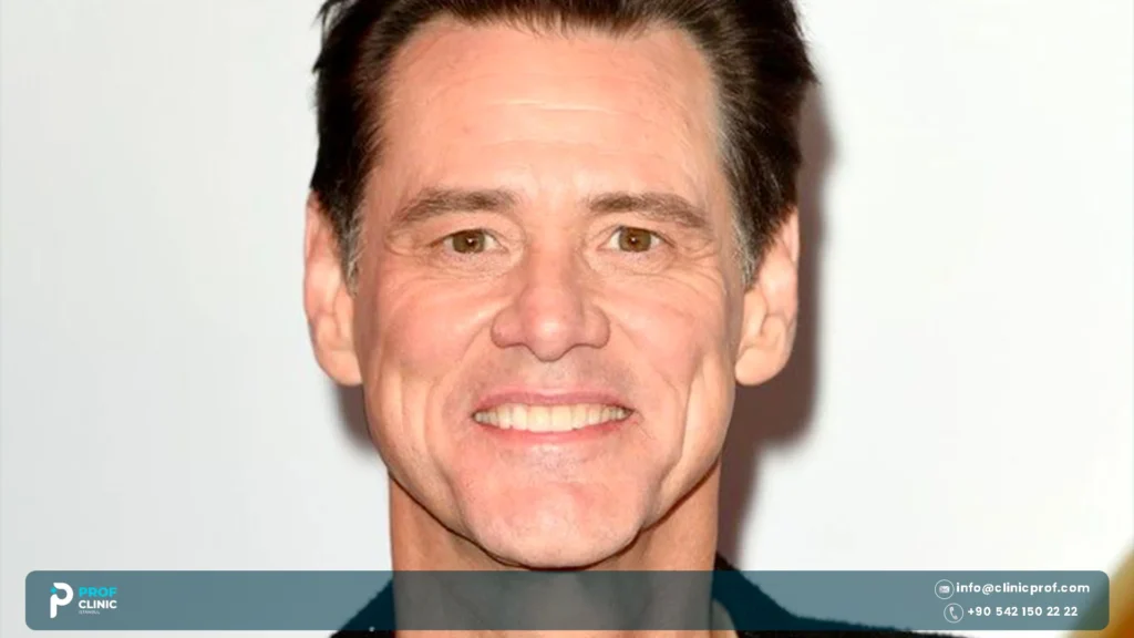 Was Jim Carrey Chipped Tooth Real or a Movie Trick?