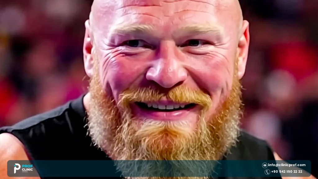 Brock Lesnar Teeth: Bottom Crowding & Combat-Sport Risk