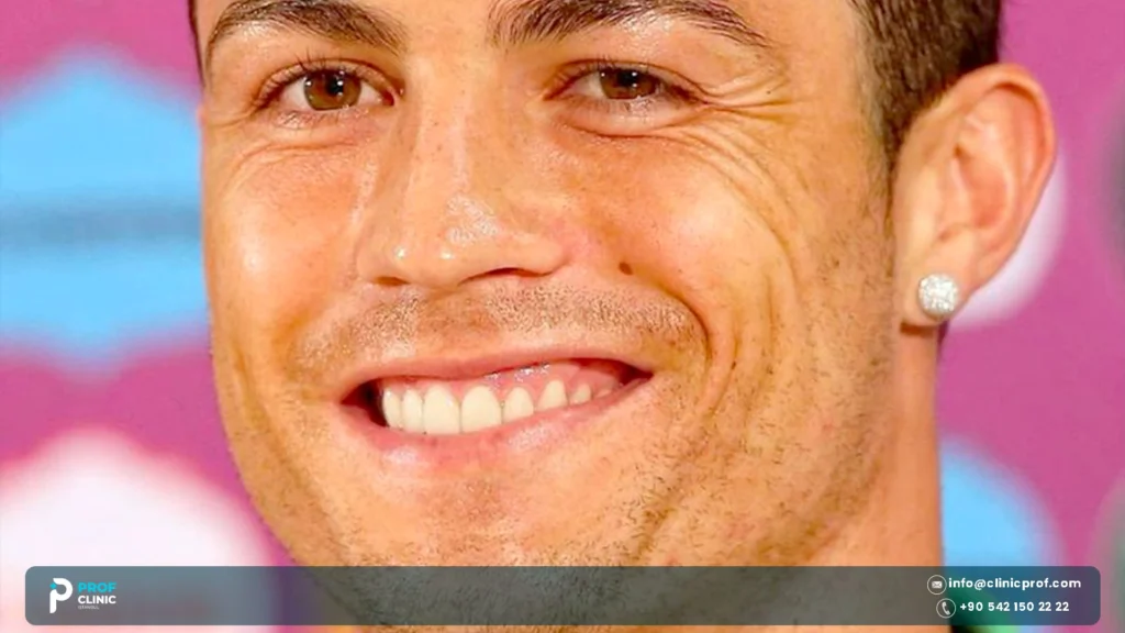 Cristiano Ronaldo Teeth Before and After: Braces to Smile Today 2 Cristiano Ronaldo Teeth: 15 Essential Smile Design Facts