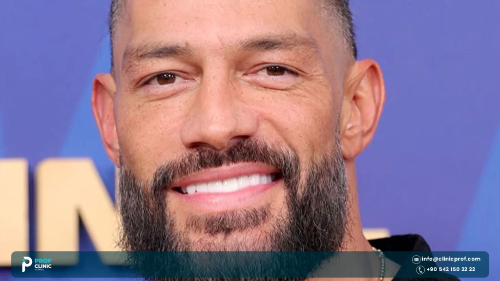 Roman Reigns Teeth: Ring Damage, Repairs and Smile Today 2 Roman Reigns Teeth and Smile
