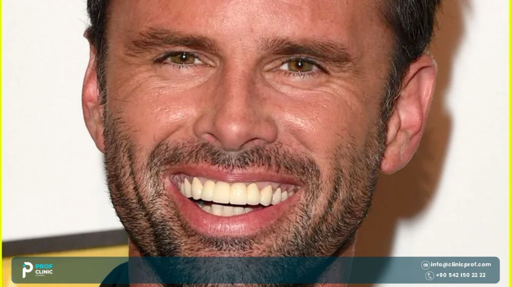 Walton Goggins teeth explained 2026