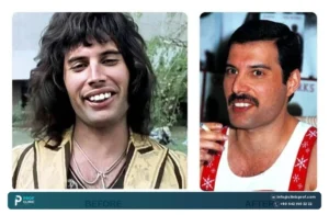 Did Freddie Mercury Really Have Extra Teeth?