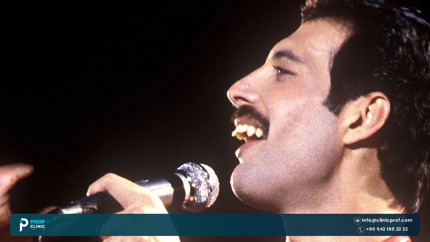 Did Freddie Mercury have extra teeth