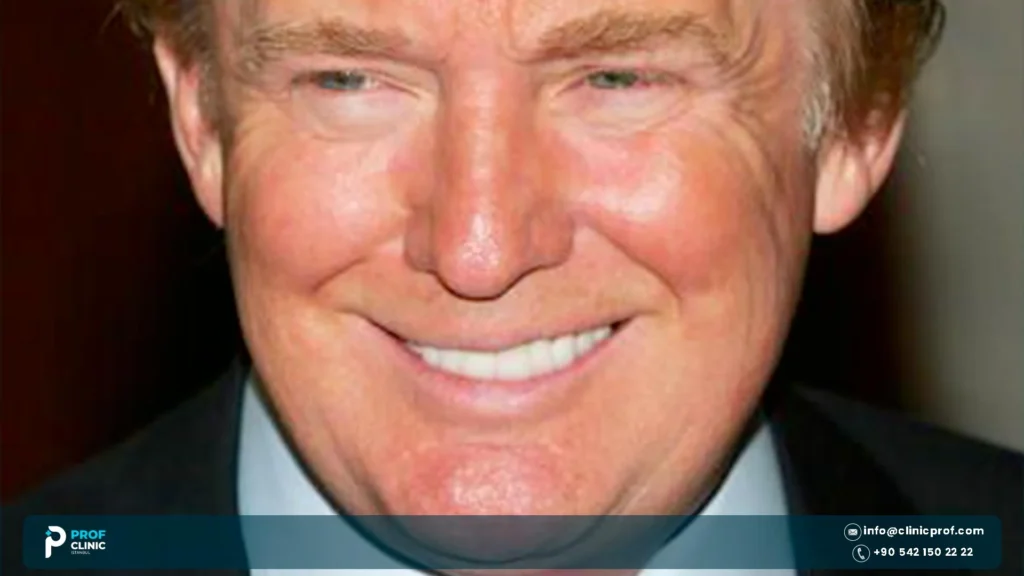 Donald Trump's Teeth: Dentures, Crowns or Real? 1 Donald Trump teeth explained