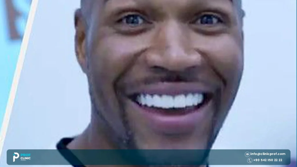 Michael Strahan Teeth: Did He Ever Close His Gap? 1 Michael Strahan gap before and after