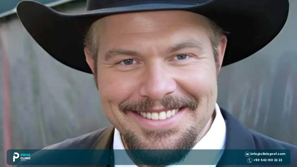 Toby Keith Teeth before and after
