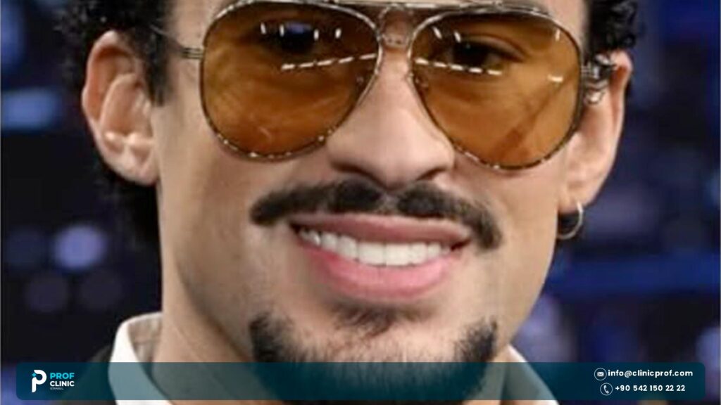 Does Bad Bunny have veneers?