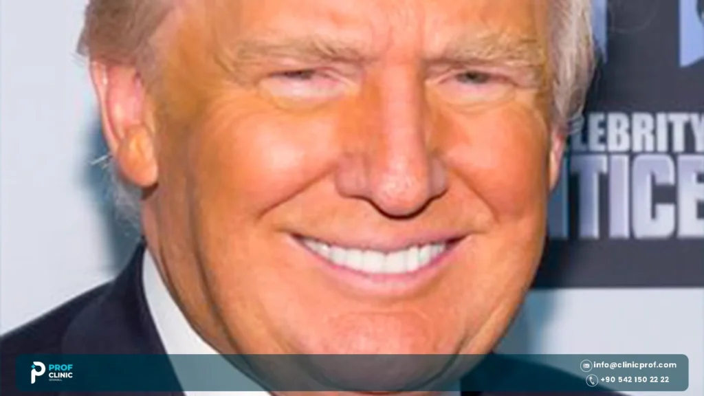 Donald Trump's Teeth: Dentures, Crowns or Real?