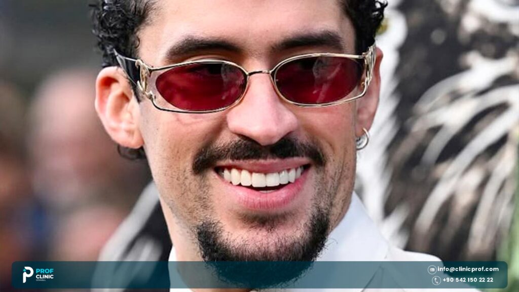 Bad Bunny teeth before veneers