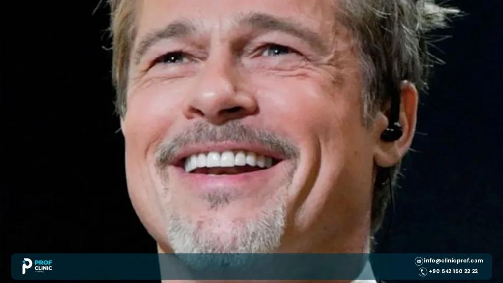 Brad Pitt Chipped Tooth: The Fight Club Story
