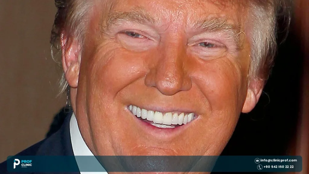 Donald Trump's Teeth: Dentures, Crowns or Real? 2 Does Donald Trump Wear Dentures or Have Crowns?