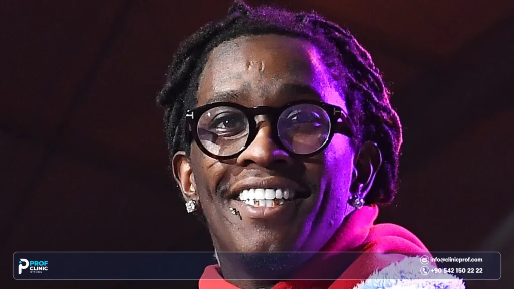 Young Thug's Teeth Before Fame and After: What Changed? 2 Young Thug Teeth Before and After