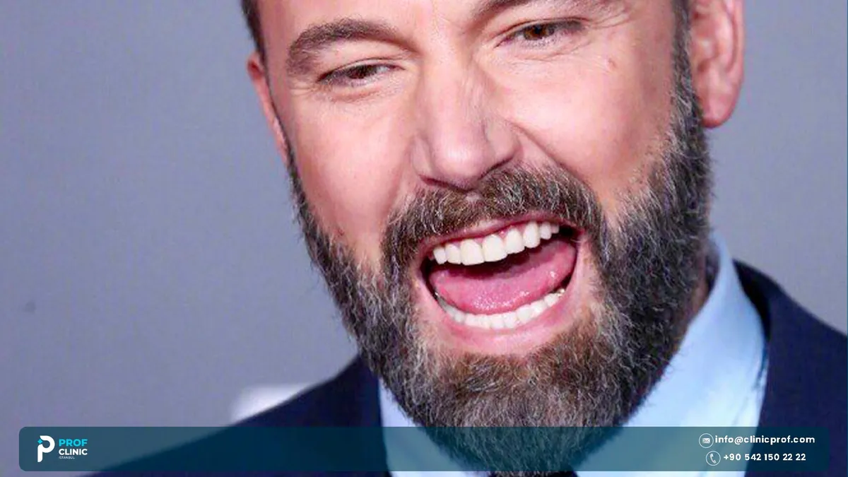 Ben Affleck laughing in a close-up portrait showing his teeth