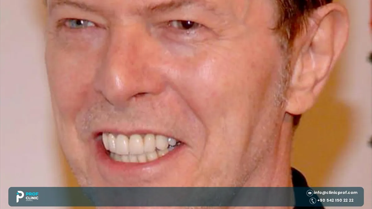 Close-up of David Bowie smiling at an event