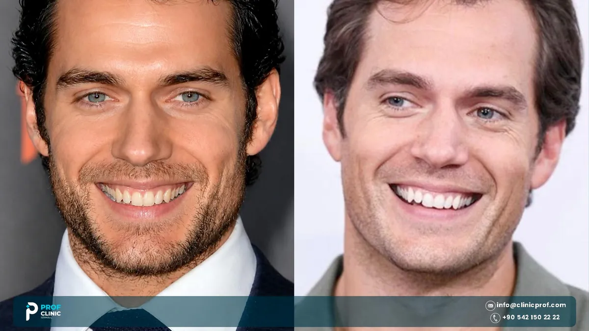Henry Cavill smile in two photographs, one in a dark suit at an event and one in a grey shirt