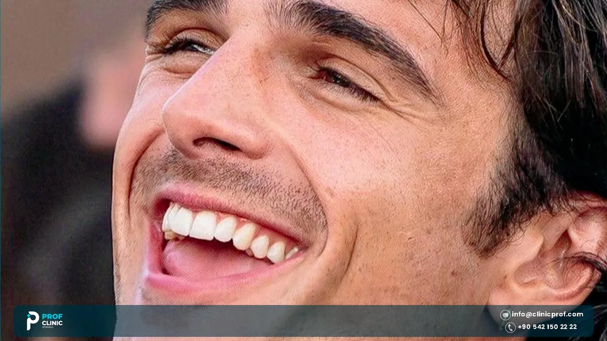 Close-up of Jacob Elordi laughing with the gum line above his upper teeth in view