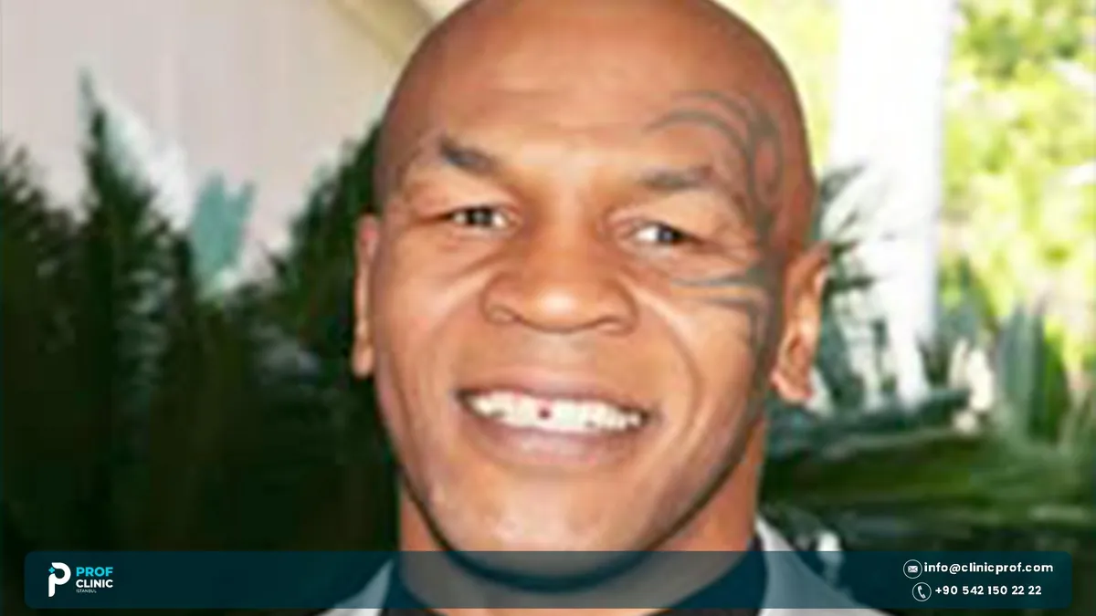 Mike Tyson smiling with a visible gap between his upper front teeth