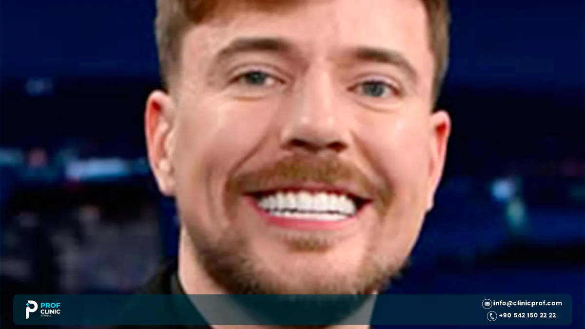 Close-up of MrBeast smiling against a dark background, Mr Beast teeth visible