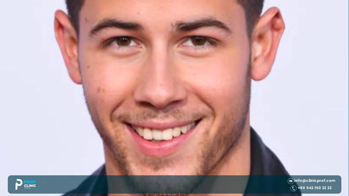 Nick Jonas smiling with his upper front teeth in view, Nick Jonas teeth