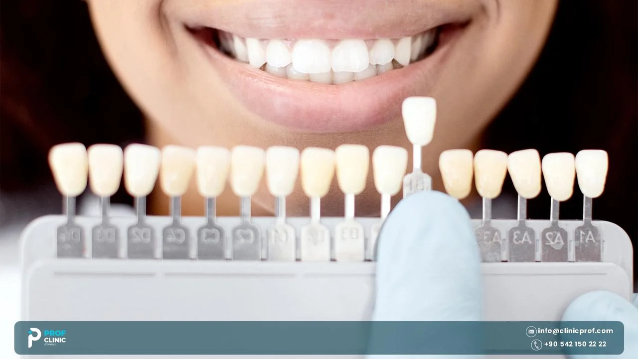 Tooth shade guide held next to a bright smile
